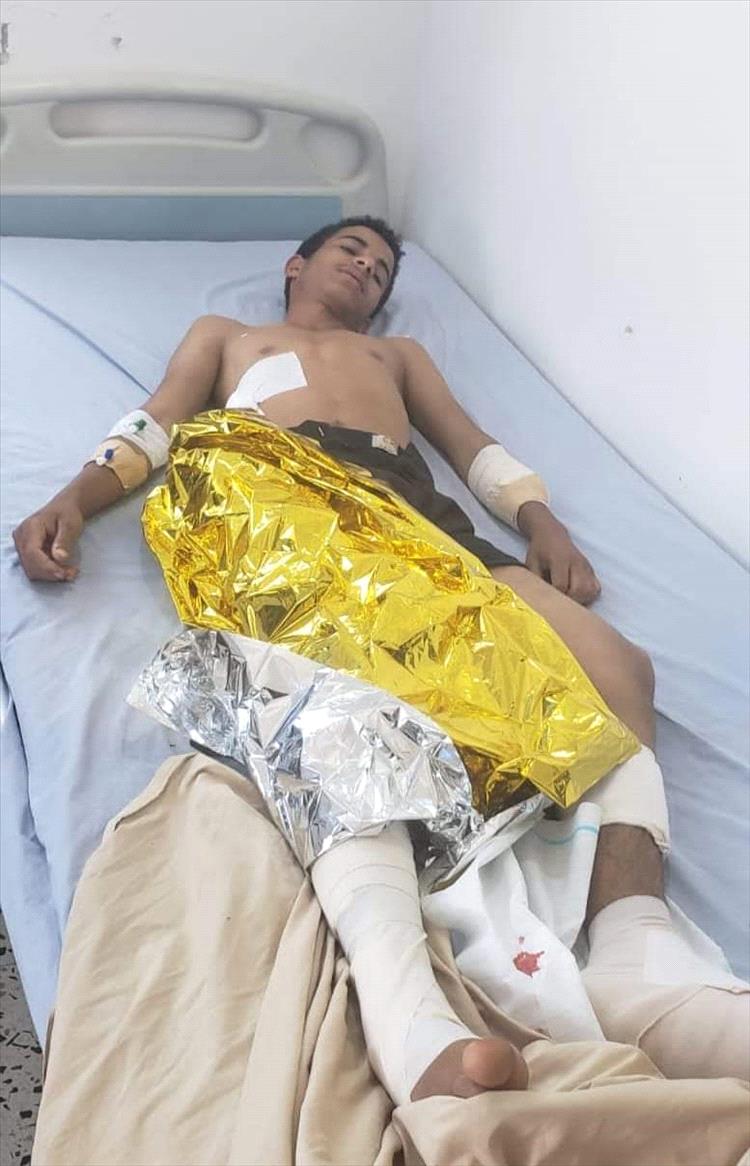 5dd20186 27b4 493a 81e8 d0c5e13ddde5 - صور.. انفجار مقذوف حوثي شمال الضالع يتسبب في إصابة ثلاثة أطفال