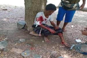 اصابة قيادي من قوات درع الوطن في مواجهة الحوثيين بلحج

