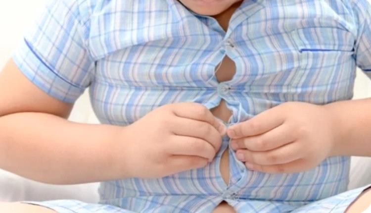 دراسة تحدد مسارات توريث السمنة من الآباء إلى الأطفال