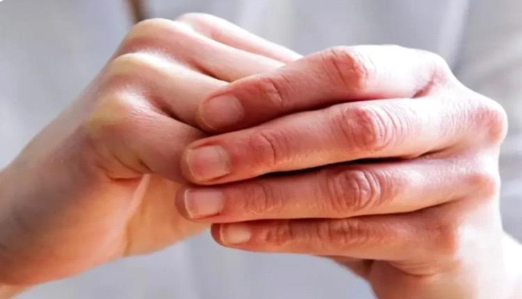 5 علامات على اليدين تشير إلى مشاكل صحية