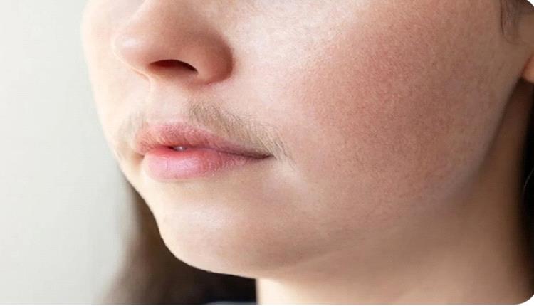 الشعر على وجه المرأة.. متى يكون طبيعيا ومتى يستدعي القلق؟