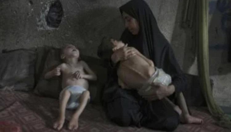 الأطفال والرضع فى غزة يمرضون ويموتون جوعا