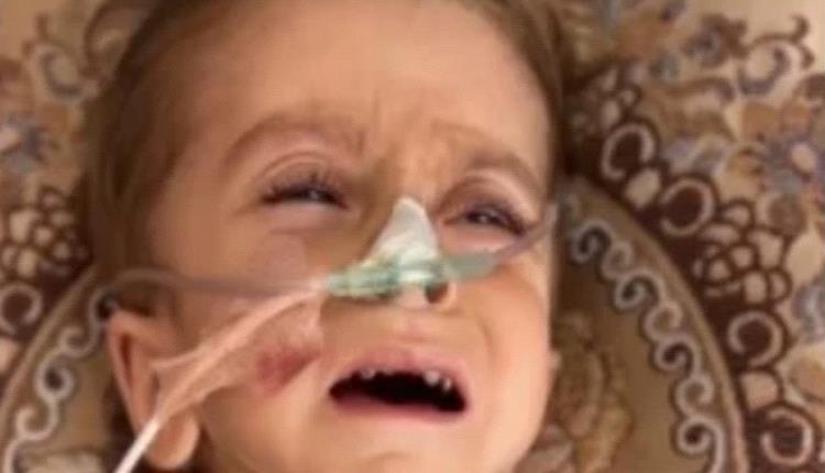 سوء التغذية يتسبب في تضخم بالكبد ولا أدوية بمستشفيات غزة