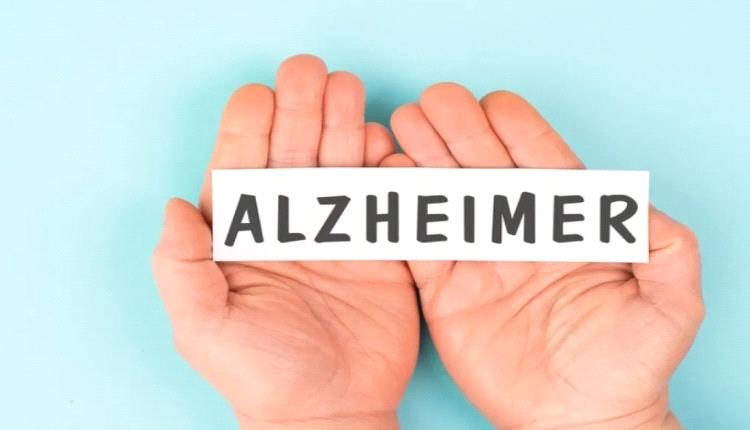 طريقة روسية جديدة لعلاج ألزهايمر