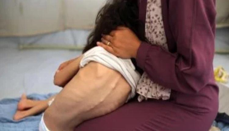 10 شهداء بينها 3 أطفال نتيجة التجويع في غزة خلال الساعات الماضية