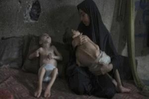 الأطفال والرضع فى غزة يمرضون ويموتون جوعا