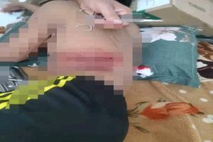 
طعن مواطن في عسيلان على يد أربعة إثيوبيين (صورة مؤلمة)
