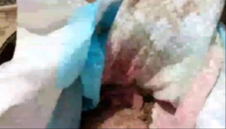 تقشعر لها الأبدان: ذبحوا رضيعة ودفنوها في كرتون خلف مستشفى بالضالع وكشفتهم امرأة مسنة

