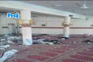 مجنون يرتكب مجزرة في رداع بالبيضاء
