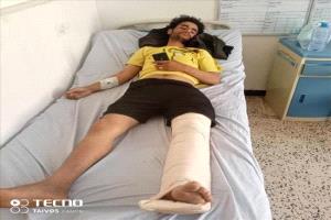 إصابة مواطن برصاص قناصة ميليشيا الحوثي في منطقة حمرالسادة بالضالع
