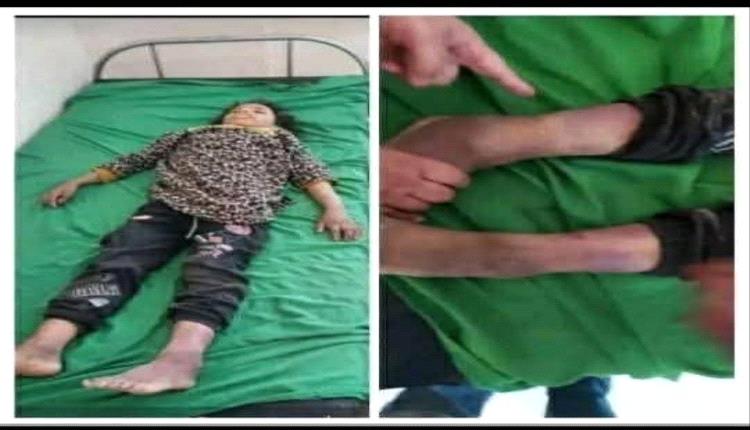 جريمة قتل الطفلة 
