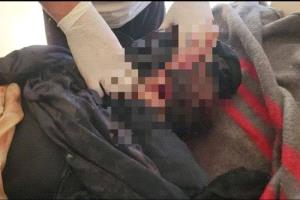 استشهاد أم برصاص قناص حوثي على أطراف الحد
