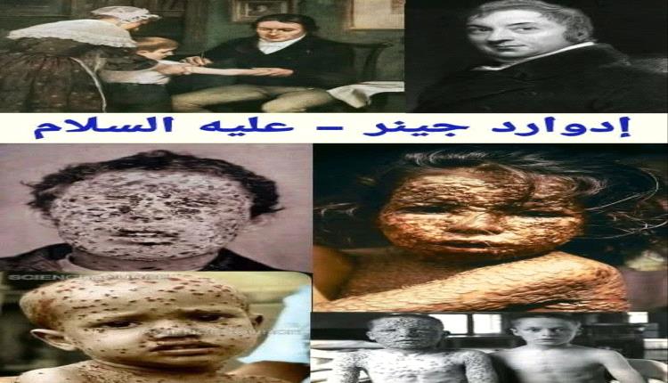 الجدري: الإمبراطورية القاتلة التي أسقطها العلم — دراسة تاريخية تحليليّة شاملة