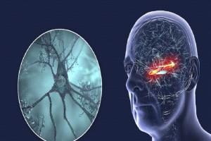 أداة جديدة تتنبأ بخطر ألزهايمر قبل سنوات من ظهور الأعراض