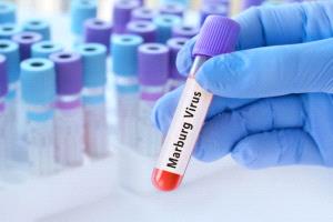 إثيوبيا تعلن تفشي وباء ماربورغ جنوب البلاد