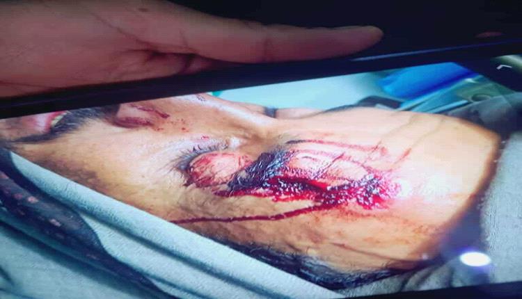 مدير مدرسة يضرب معلما، وأقرباء لطلاب يضربون معلمين في  مدارس أخرى في الضالع