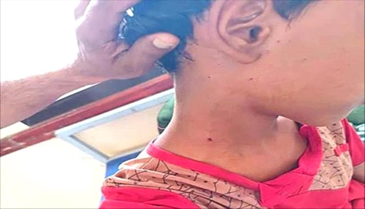 رصاص قناص حوثي يصيب طفلًا في القبيطة بلحج
