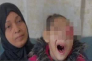 رغم سفرها للعلاج خارج غزة.. وفاة الطفلة هناء العوضى بعد نهش السرطان جسدها