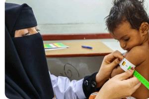 مسؤول أممي يحذر من تفاقم المجاعة في اليمن
