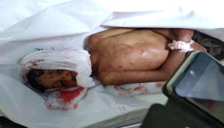 
للتوضيح في حادثة القتل في منطقة البجح الضالع