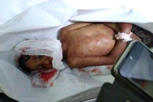 
للتوضيح في حادثة القتل في منطقة البجح الضالع