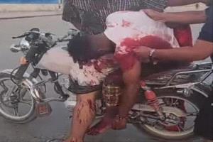 القوات التي اطلقت النار على المتظاهرين السلميين من أبناء حضرموت الأبية، هي قوات الطوارئ اليمنية الإخوانية، المدعومة سعوديا.