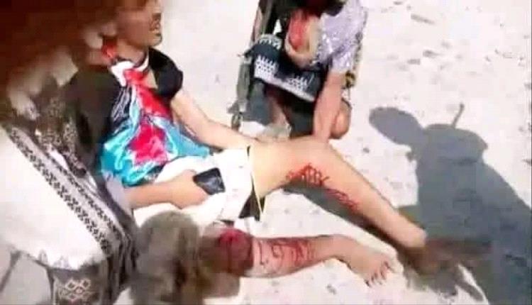 قوات الاحتلال اليمني المدعومة سعوديا تعتدي بالرصاص الحي على متظاهرين سلميين أمام مطار سيئون في وادي حضرموت