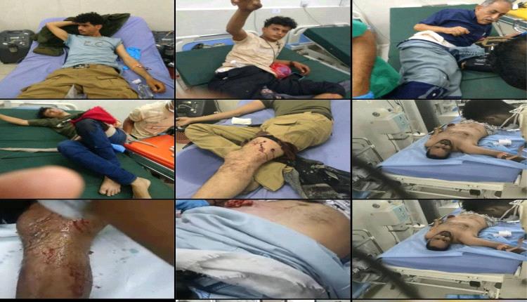 بيان  للمجلس الانتقالي محافظة الضالع يدين الجريمة النكراء  بحق المتظاهرين السلميين أمام قصر معاشيق بالعاصمة عدن