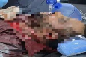 رصاص قوى الاحتلال في عتق يشعل جذوة التحرر الجنوبي