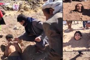 خرافات الحوثي تدفع عائلات لدفن مرضى الصرع بالتراب في إب اليمنية
