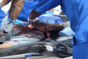 مصدر طبي: 21 شهيدا وجريحا في عتق بنيران الأمن في شبوة