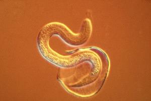 تهديد طفيلي آكل للحوم يقترب من الولايات المتحدة
