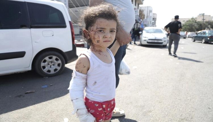 الأمم المتحدة: حوالي 95 ألف طفل في غزة يعانون من سوء التغذية الحاد