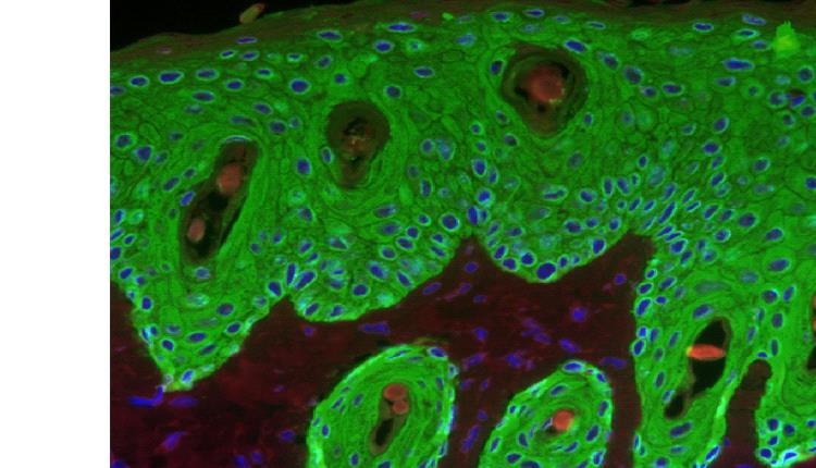 نهج ياباني جديد يحول الخلايا الجذعية إلى مؤشرات ضوئية للتوتر والالتهاب