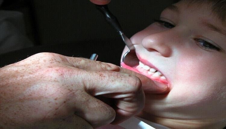 رصد عامل جديد لالتهابات اللثة الشديدة!