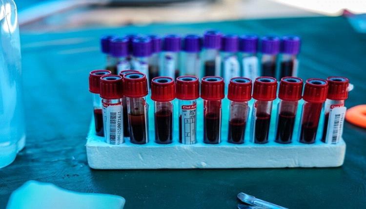 خمسة مؤشرات في الدم تكشف مشكلات صحية خطيرة