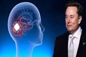 ماسك: نيورالينك تخطط لإنتاج كميات كبيرة من شرائح الدماغ في 2026