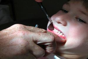 رصد عامل جديد لالتهابات اللثة الشديدة!