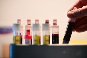 فحوصات سنوية أساسية تكشف الأمراض قبل ظهور الأعراض