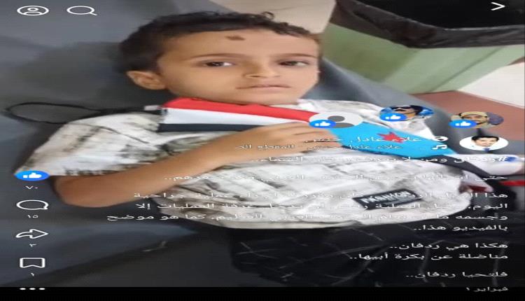 رفض اجراء عملية الا وعلم الجنوب يلتف جسمه.. الشبل سيف بحاجة لوقفتنا ضد مرض السرطان.!؟