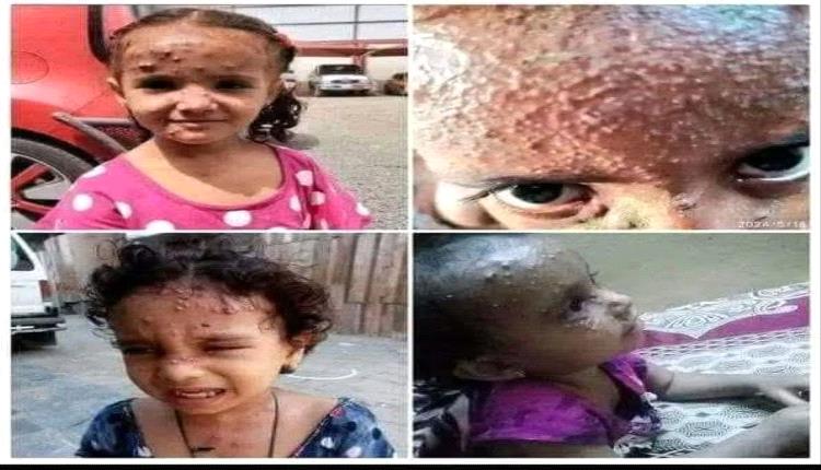 في عهد الوصاية السعودية تعيش عدن أسوأ مراحل الحياة والخدمات