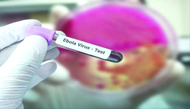 إيبولا يختبئ في الدماغ لأشهر.. اكتشاف يثير القلق
