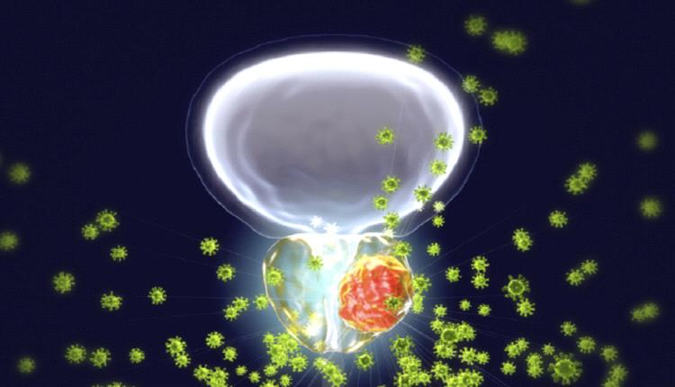 دكتور يحذر: العلاقة الحميمة لا تكفي للوقاية من سرطان البروستاتا