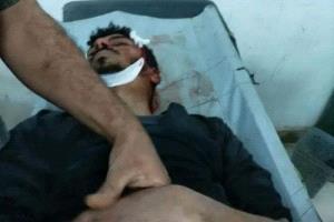 استشهاد شاب من الأزارق خلال مواجهات مع المليشيا الحوثية