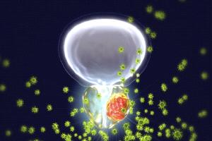 دكتور يحذر: العلاقة الحميمة لا تكفي للوقاية من سرطان البروستاتا