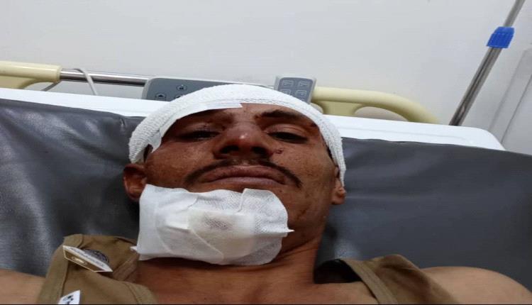 بيان صادر عن قبيلة القراميش
بخصوص حادثة الاعتداء على سائق الباص فجر الاثنين 18/05/2026م