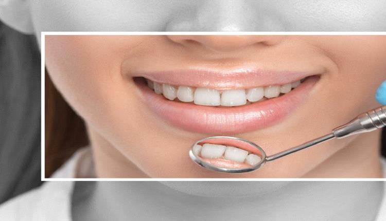 اكتشاف طريقة جديدة لحماية الأسنان من التسوس