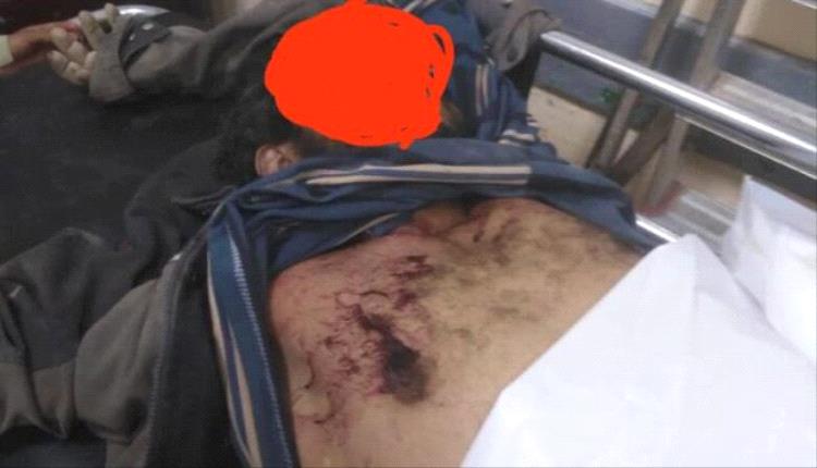 مقتل عامل برصاص قيادي حوثي في صعدة اليمنية
