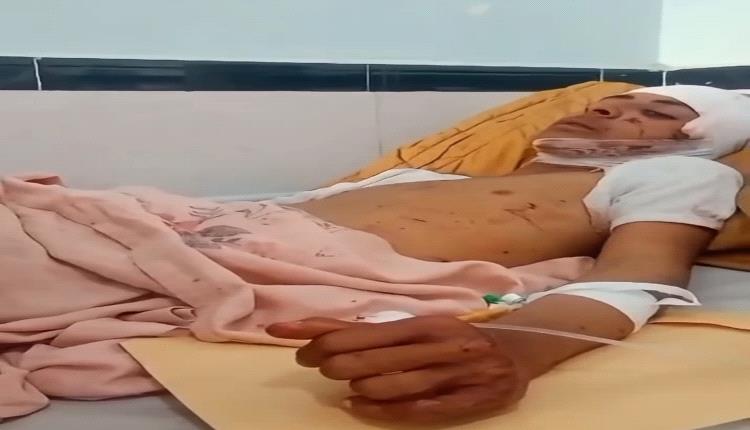 الجريح البطل عبدالحكيم الربيز أحد جرحى مجزرة الصواريخ البالستية التي استهدفت معسكر العلم م شبوة.