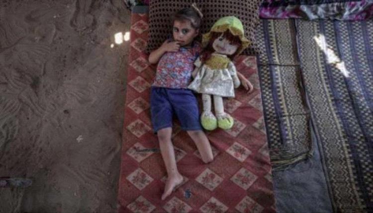 صحة غزة: 5 آلاف حالة بتر و10 آلاف بحاجة لتأهيل طويل الأمد